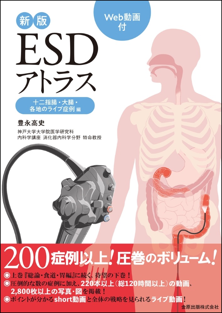 新版ESDアトラス 十二指腸・大腸・各地のライブ症例編［Web動画付］